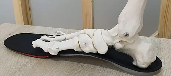 Plantillas a medida y siliconas